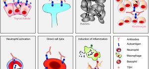 how are autoantibodies diagnosed and treated today