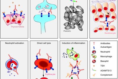 How are autoantibodies diagnosed and treated today 2 how are autoantibodies diagnosed and treated today