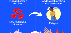 what causes gauchers disease and what are its treatments