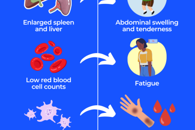 what causes gauchers disease and what are its treatments