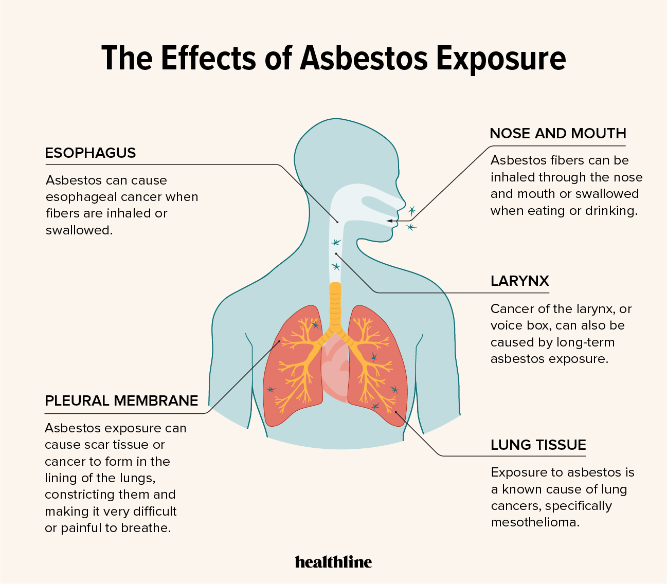 What Is Asbestosis and How Does It Affect Lung Health 1 what is asbestosis and how does it affect lung health